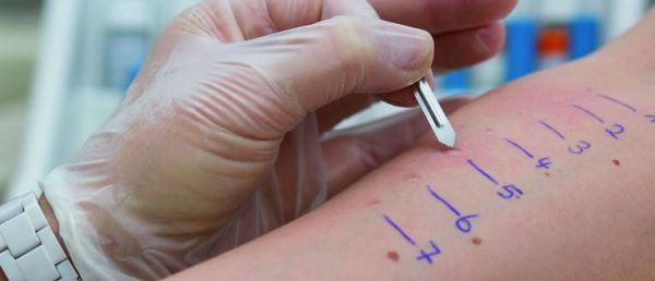 Lancetas para Prick Test - Imagen 2